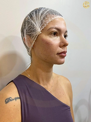 Foto antes e depois