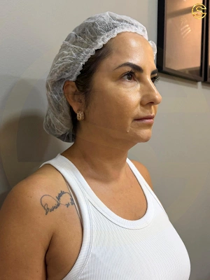 Foto antes e depois
