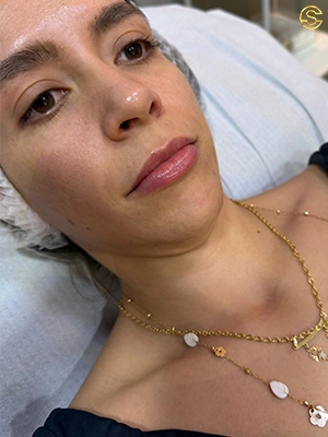 Foto antes e depois