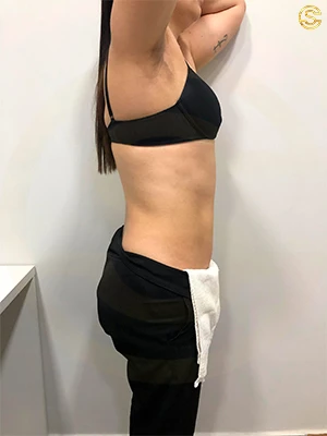 Foto antes e depois