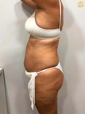 Foto antes e depois