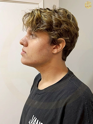 Foto antes e depois