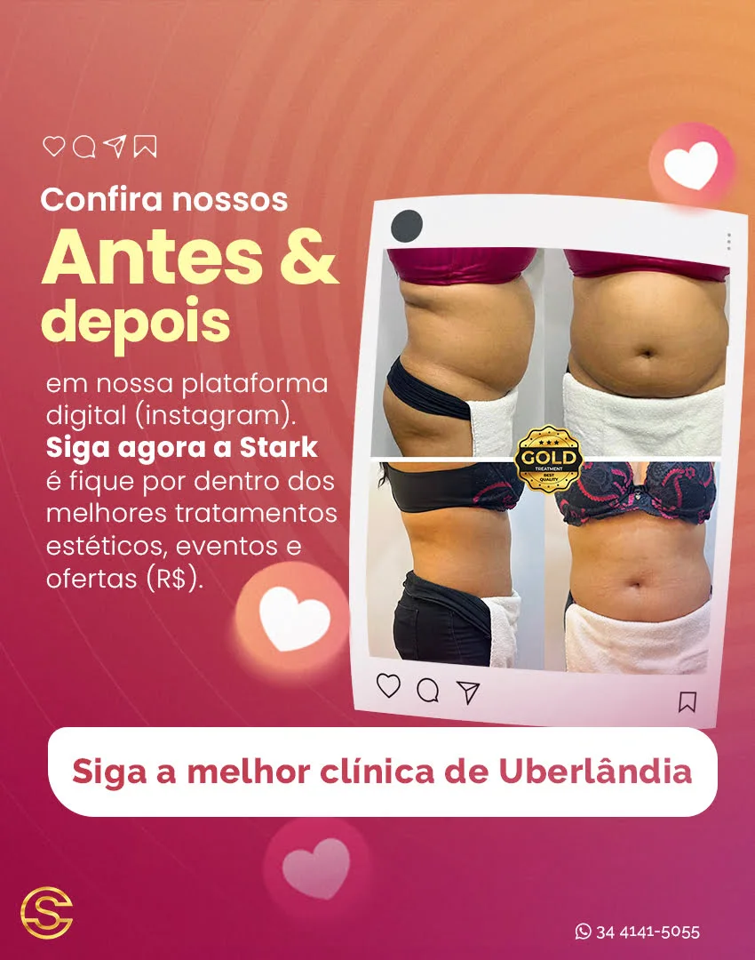 Instagram da Clínica Stark